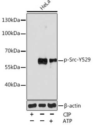 Western Blot: Src [p Tyr529] Antibody [NBP3-05396] - Western blot analysis of extracts of various cell lines, using Src pAb (NBP3-05396) at 1:1000 dilution.Hela cells were treated by ATP(5 mM) at 30C for 1 hour or treated by CIP(20uL/400ul) at 37C for 1 hour. Secondary antibody: HRP Goat Anti-Rabbit IgG (H+L) at 1:10000 dilution. Lysates/proteins: 25ug per lane. Blocking buffer: 3% nonfat dry milk in TBST. Detection: ECL Enhanced Kit. Exposure time: 180s.